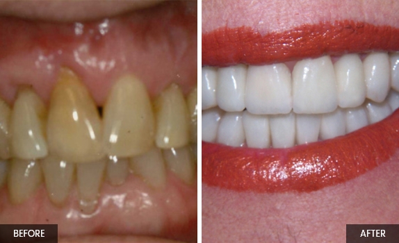 Smile-gallery1