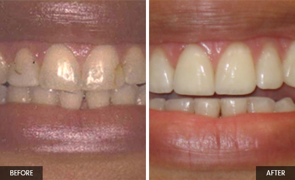 Smile-gallery2
