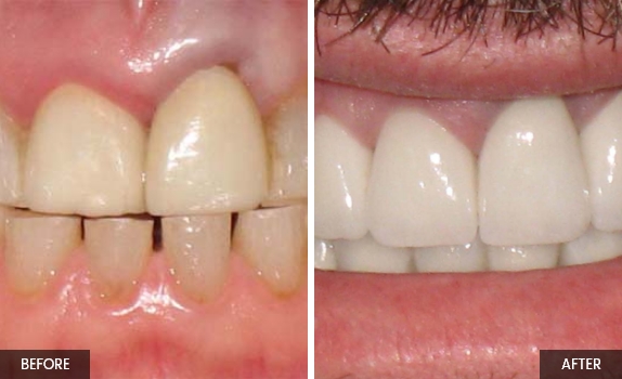 Smile-gallery3