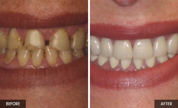 Smile-gallery4