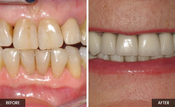 Smile-gallery5